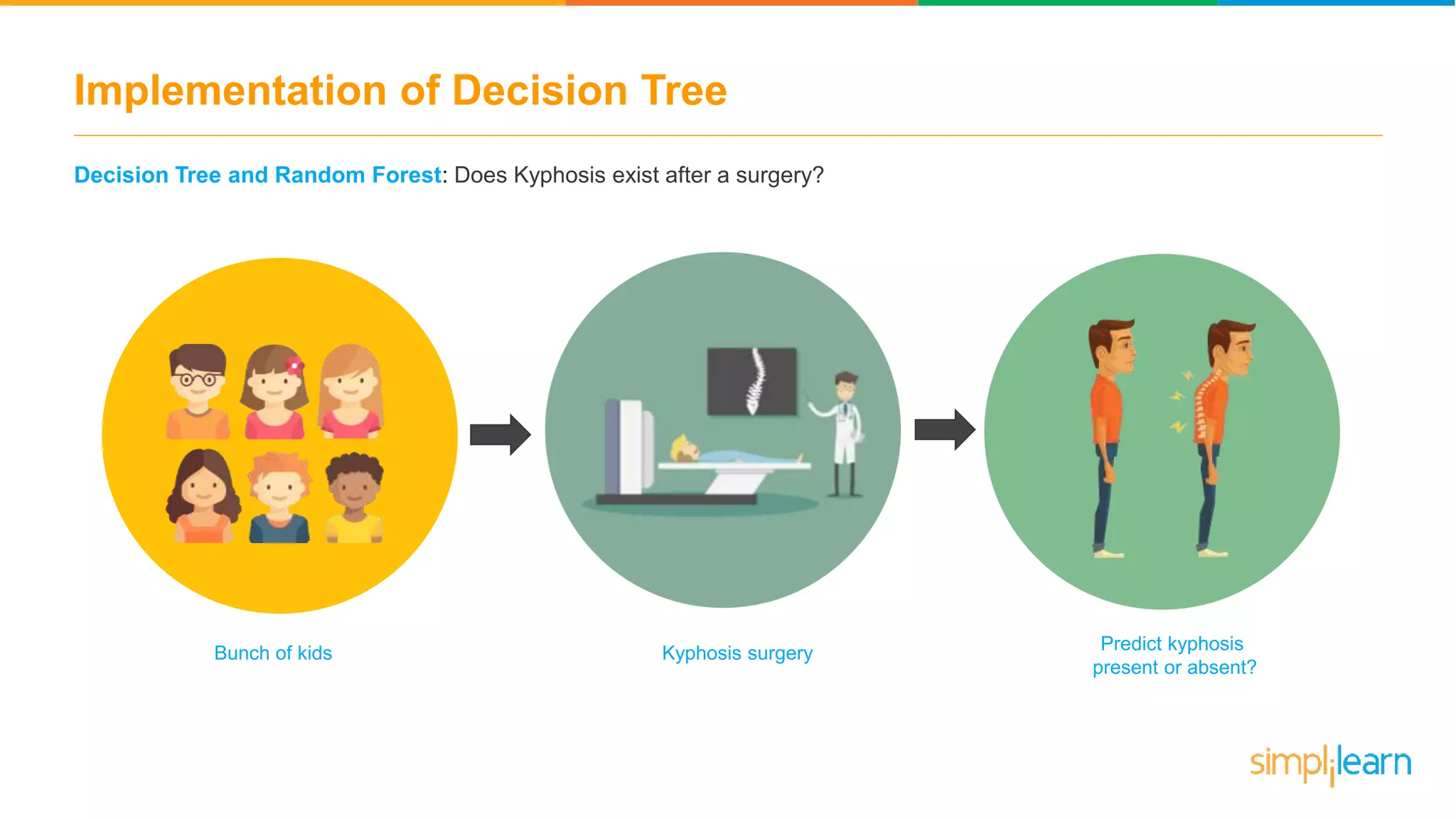 Implementation of Decision Tree
Decision Tree and Random Forest: Does Kyphosis exist after a surgery?
Bunch of kids Kyphosis surgery Predict kyphosis
present or absent?
 